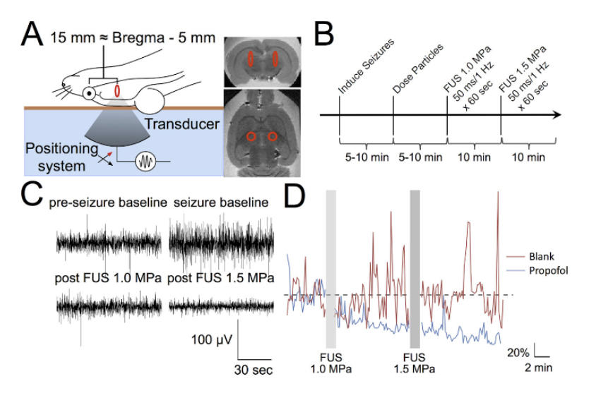 Screenshot nuromodulation