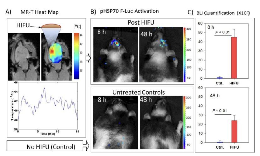 thermal-therapy_applications